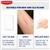 Elastoplast Scar Reducer 21 Patches