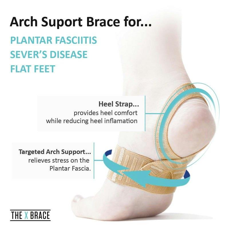 Arch brace sale for plantar fasciitis