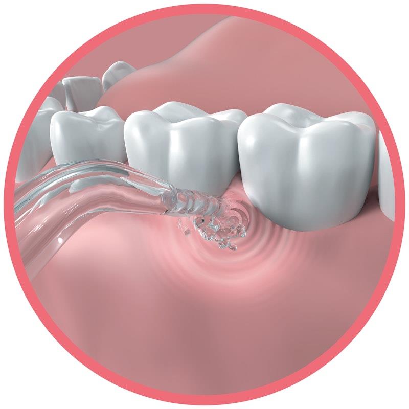 Buy GO2 Dentagenie Water Flosser 1pc Online at Chemist Warehouse®