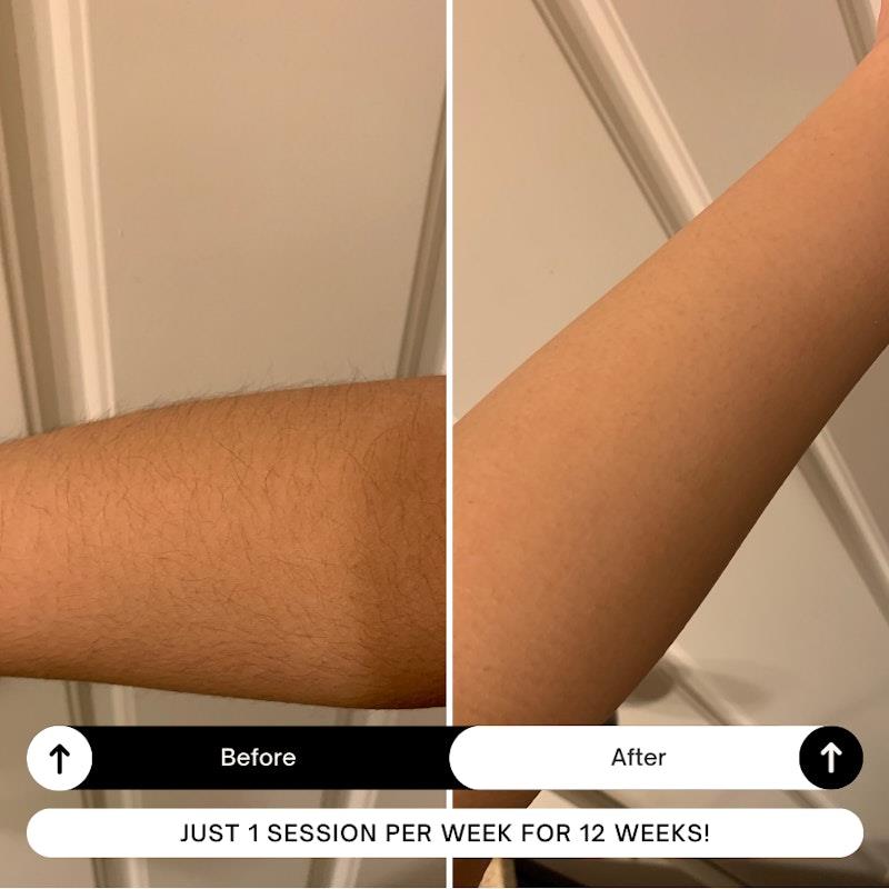 Buy Happy Skin Co Gen.2 IPL Hair Removal Handset White Online at