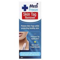 compound w freeze off skin tag remover