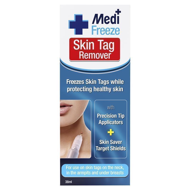 Skin tag